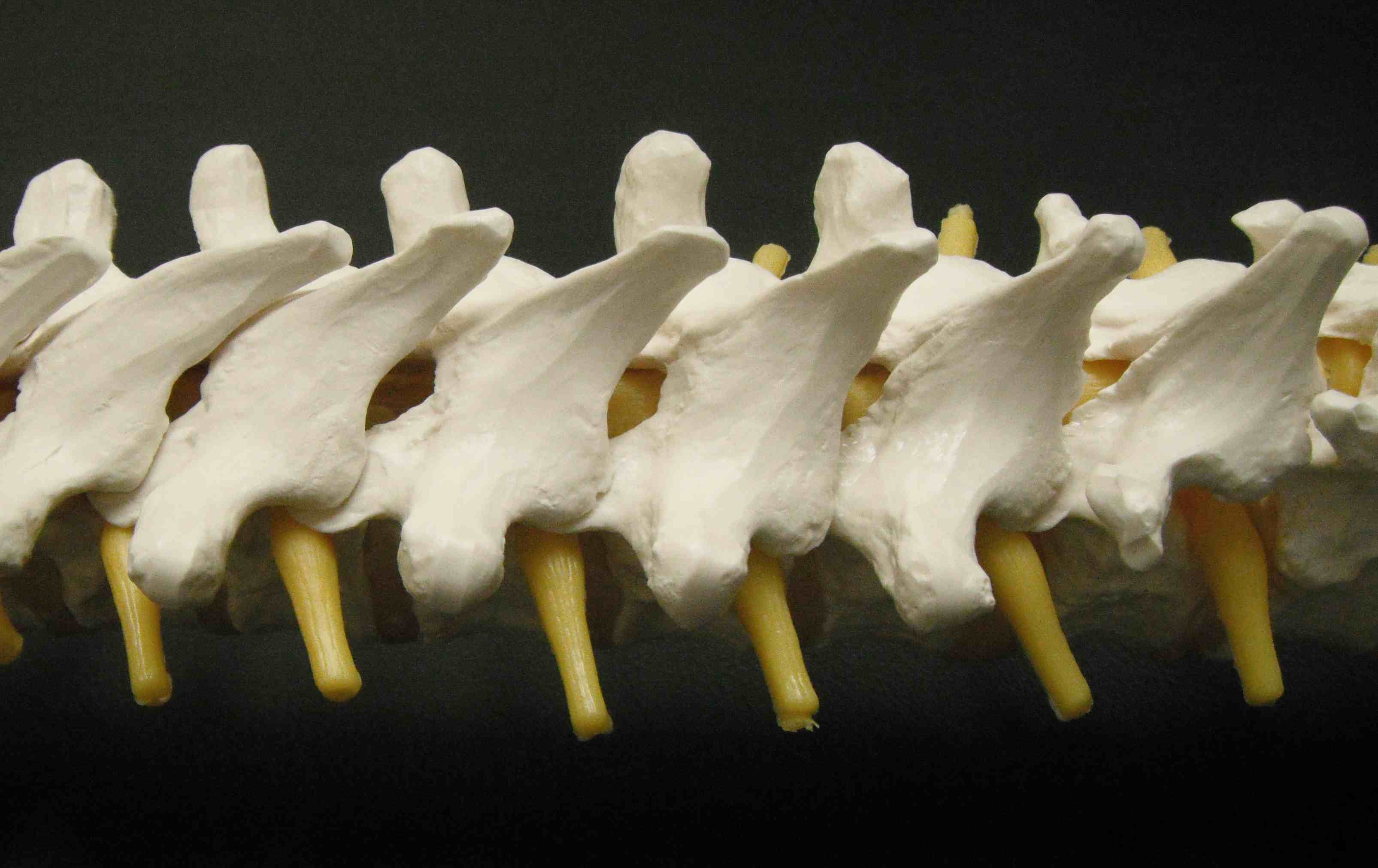 Thoracic Vertebrae